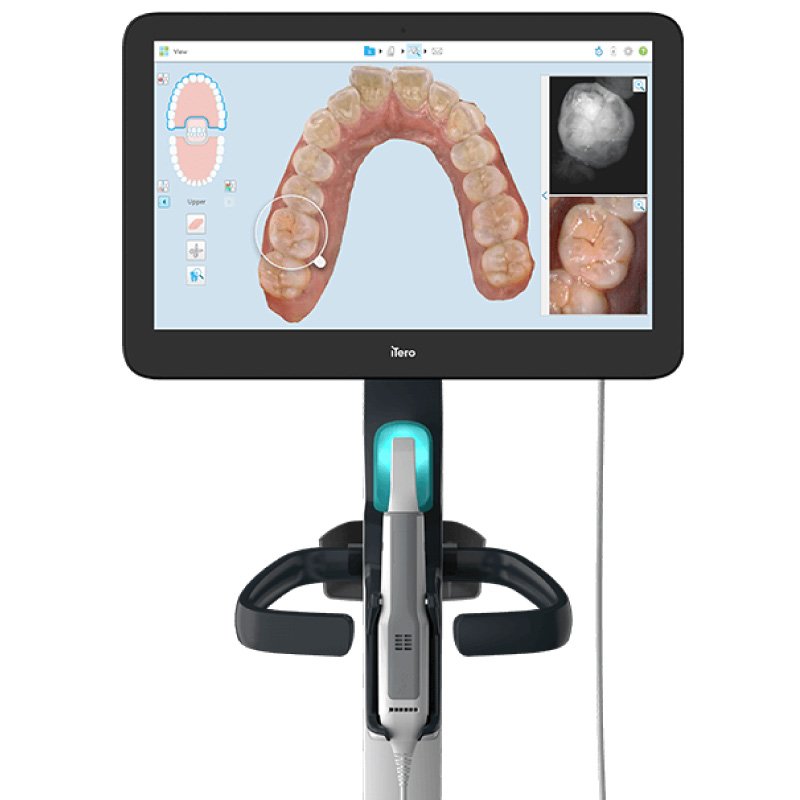 itero Element Scanner