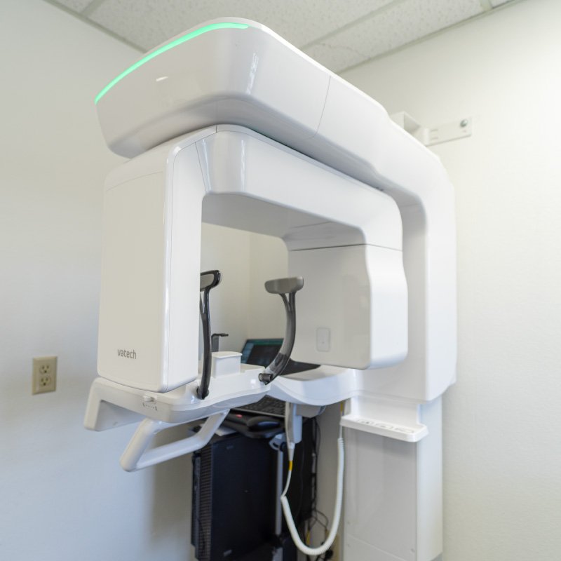CBCT